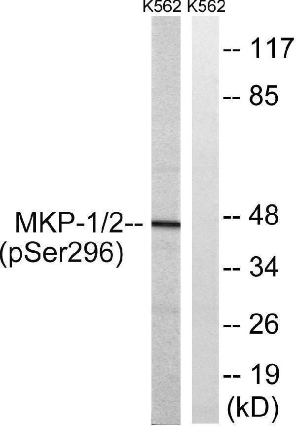Western blot analysis of lysates from K562 cells treated with heat shock , using MKP-1/2 (Phospho-Ser296/318) Antibody