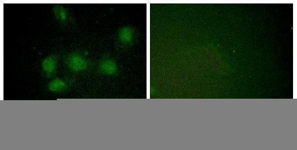 Immunofluorescence analysis of HUVEC cells, using NIFK (Phospho-Thr234) Antibody