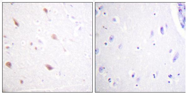 p30452 nifk primary antibodies ihc testing 4