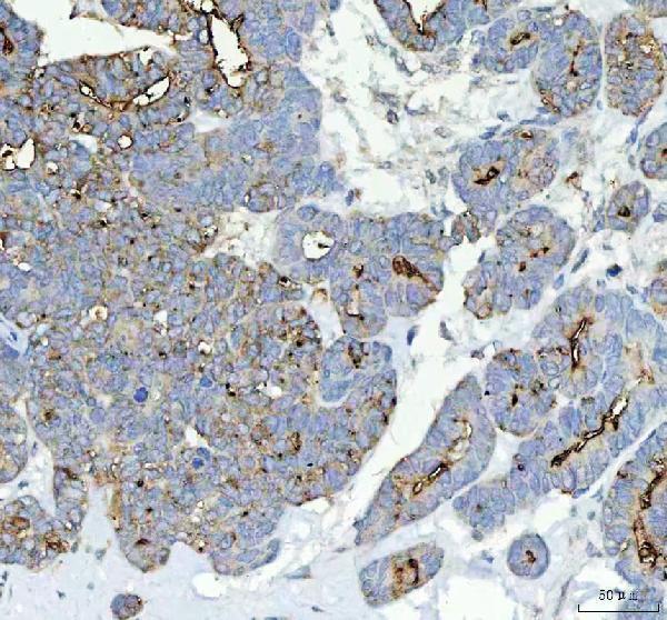 pa1004 alpl primary antibodies ihc testing 2
