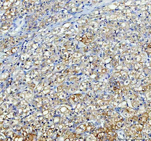 pa1004 alpl primary antibodies ihc testing 4
