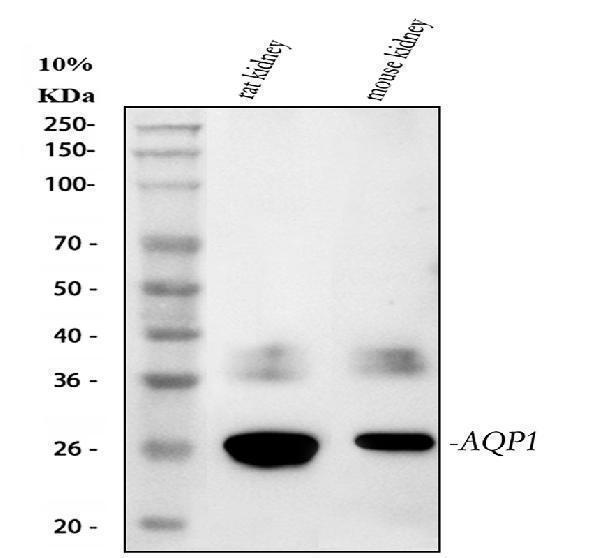  Western blot analysis of AQP1 using anti-AQP1 antibody (PA1010)