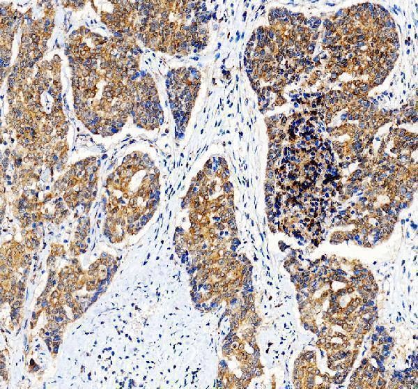pa1013 1 bax primary antibodies ihc testing 1