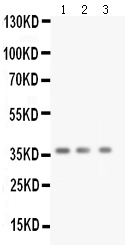 Anti-BDNF antibody, PA1014, Western blottingAll lanes: Anti BDNF (PA1014) at 0.5ug/mlLane 1: Rat Brain Tissue Lysate at 50ugLane 2: Mouse Brain Tissue Lysate at 50ugLane 3: MCF-7 Whole Cell Lysate at 40ugPredicted bind size: 28KDOb