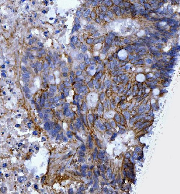pa1021 2 cd44 primary antibodies ihc testing 3