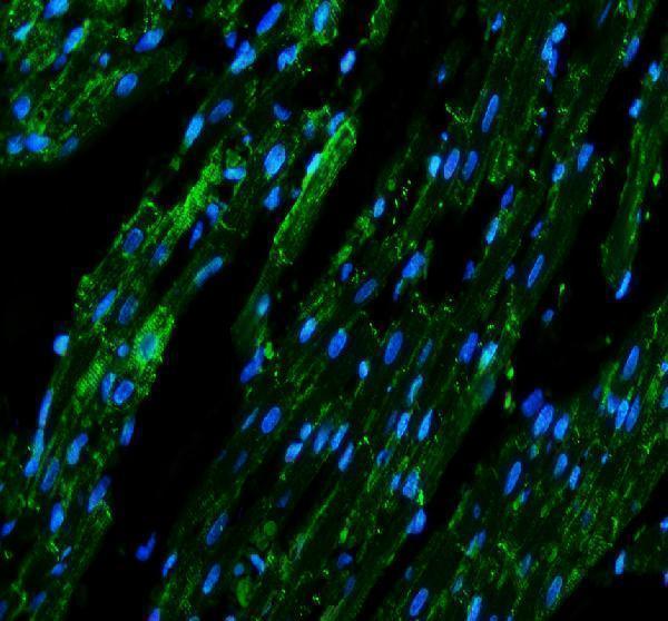 pa1026 gja1 primary antibodies if testing 1