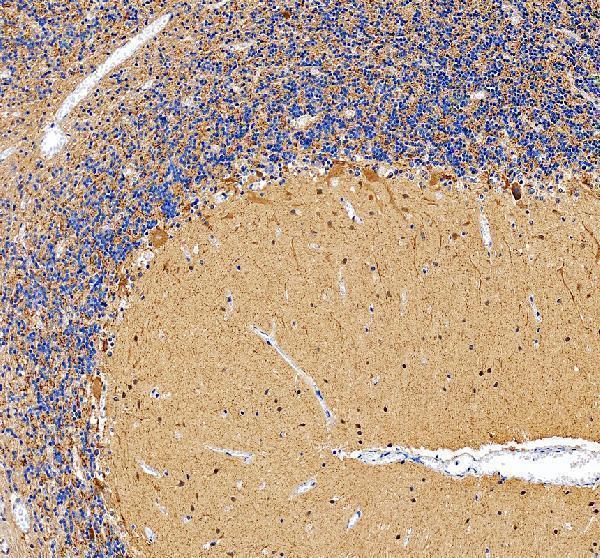 IHC analysis of GAD67 using anti-GAD67 antibody (PA1036-1)