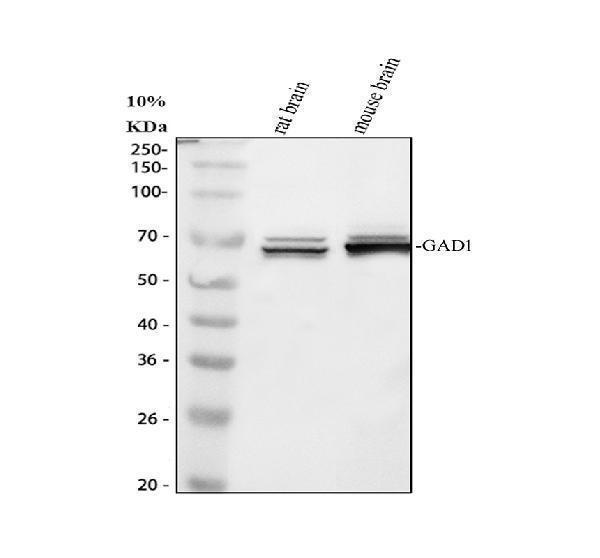 Western blot analysis of GAD67 using anti-GAD67 antibody (PA1036-1)