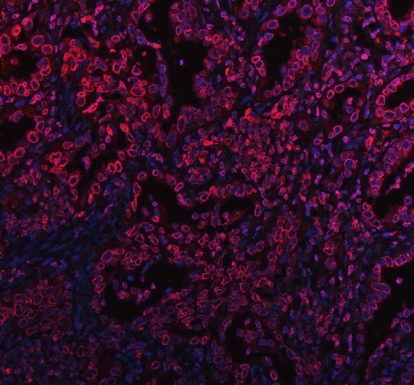 pa1048 lmnb1 primary antibodies if testing 1_1