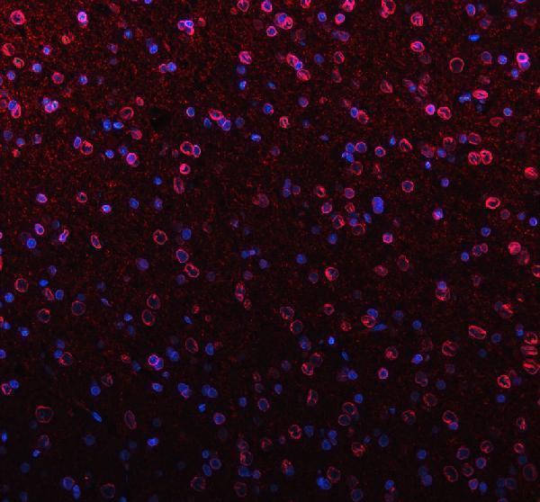 pa1048 lmnb1 primary antibodies if testing 2_1