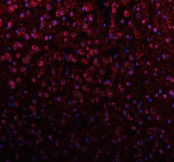 pa1048 lmnb1 primary antibodies if testing 3