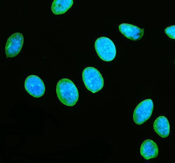 pa1048 lmnb1 primary antibodies if testing 4