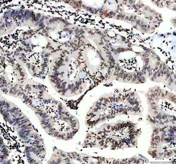 IHC analysis of Lamin B1 using anti-Lamin B1 antibody (PA1048)