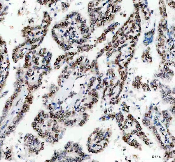 pa1048 lmnb1 primary antibodies ihc testing 3