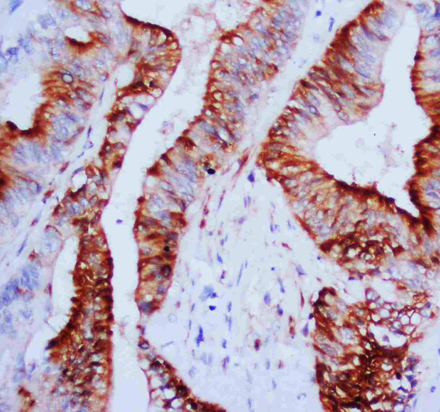 Anti-MAPK1/3 Antibody PA1049