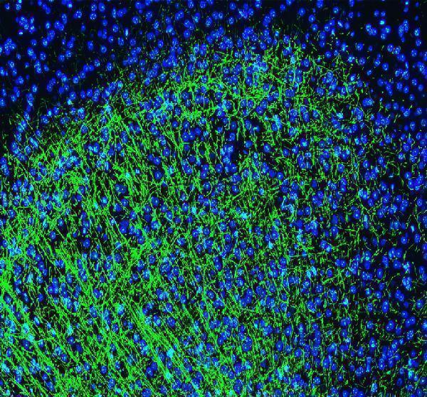 pa1050 mbp primary antibodies if testing 1