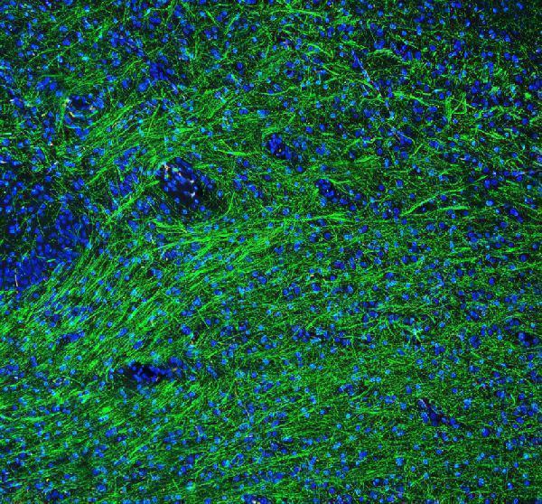 pa1050 mbp primary antibodies if testing 2