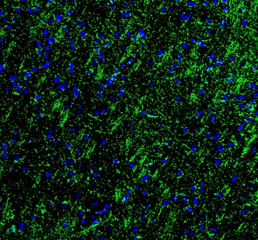 pa1050 mbp primary antibodies if testing 5