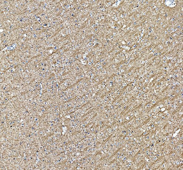 pa1050 mbp primary antibodies ihc testing 1