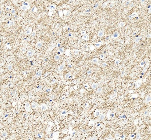 pa1050 mbp primary antibodies ihc testing 11