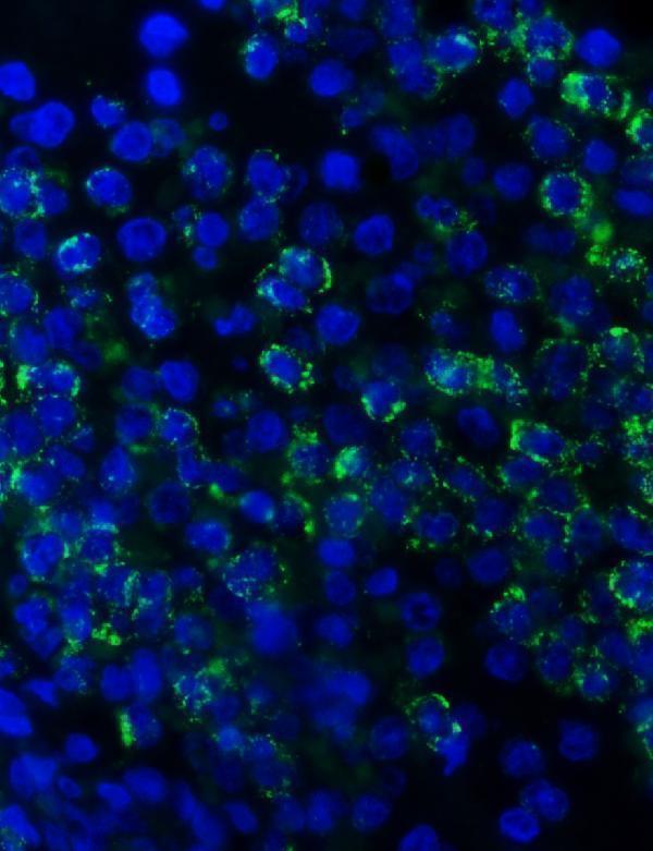 pa1054 mpo primary antibodies if testing 5