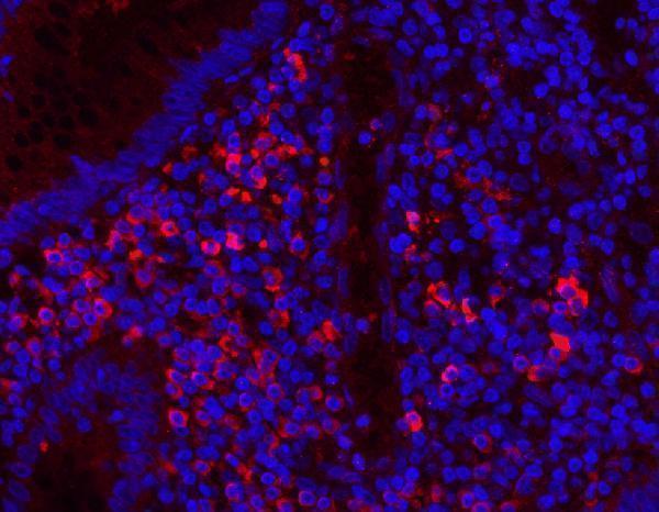 pa1054 mpo primary antibodies if testing 6