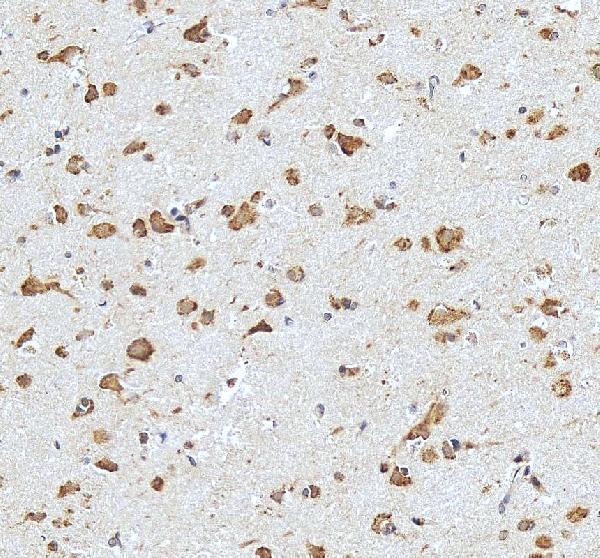 pa1058 1 grin2a primary antibodies ihc testing 3
