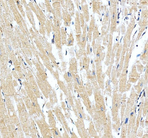 pa1058 1 grin2a primary antibodies ihc testing 4