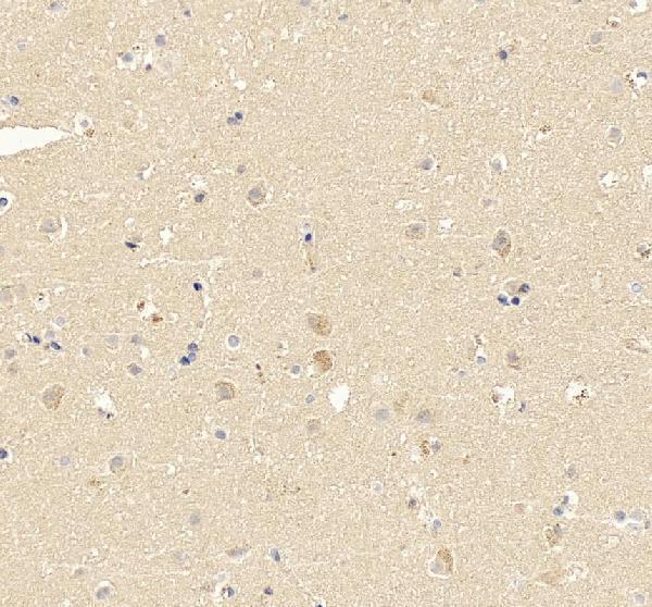 pa1061 eno2 primary antibodies ihc testing 3