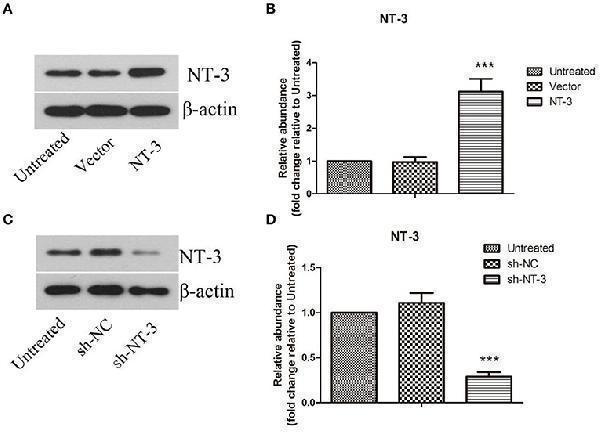 Lentivirus-mediated overexpression or interference of NT-3 in BMSCs