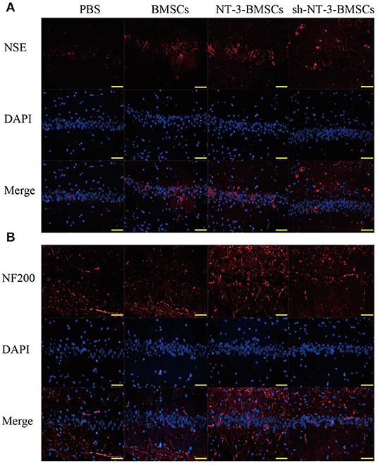 pa1062 fncel 15 629356 g006