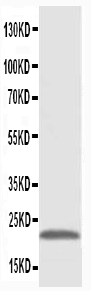 pa1067 1 wb anti pmvk phosphomevalonate kinase antibody