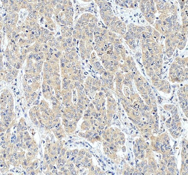 pa1067 pmvk primary antibodies ihc testing 3