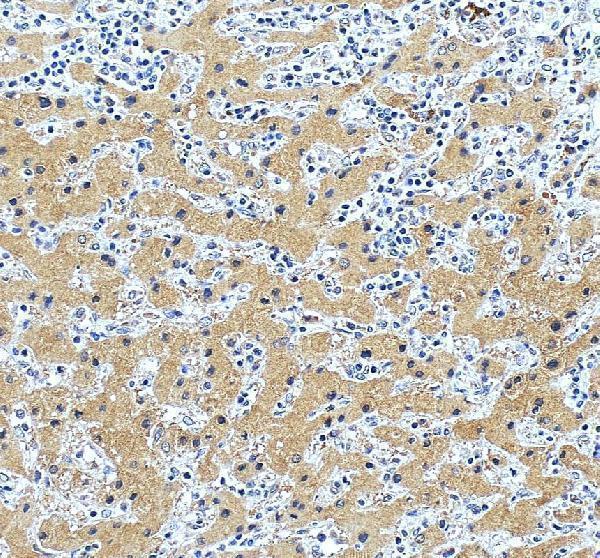 pa1067 pmvk primary antibodies ihc testing 4