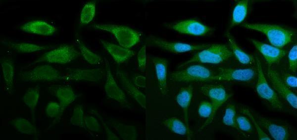 pa1075 stat1 primary antibodies if testing 2