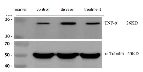  Western blot analysis of TNF alpha using anti-TNF alpha antibody (PA1079)