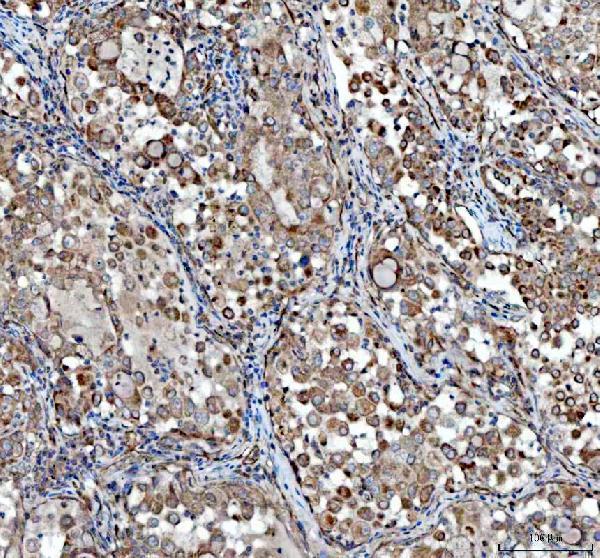 pa1080 vegfa primary antibodies ihc testing 2