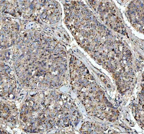 pa1080 vegfa primary antibodies ihc testing 3