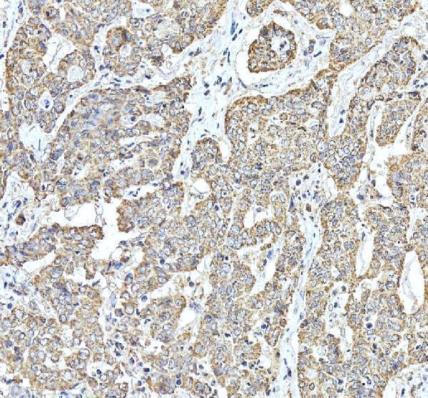 pa1106 hspd1 primary antibodies ihc testing 5