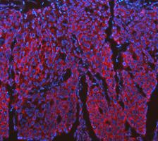 pa1118 cycs primary antibodies if testing 1_1