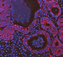 pa1118 cycs primary antibodies if testing 3