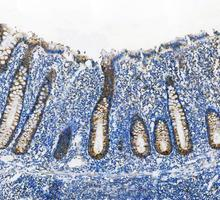 pa1118 cycs primary antibodies ihc testing 5