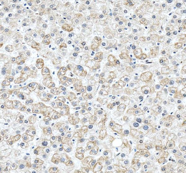 IHC analysis of Cytochrome c/CYCS using anti-Cytochrome c/CYCS antibody (PA1118)