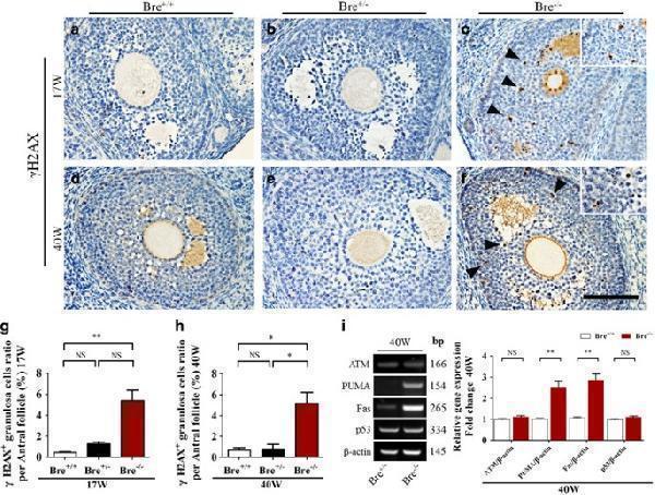 pa1119 41419_2017_article_bfcddis201791_fig7_html