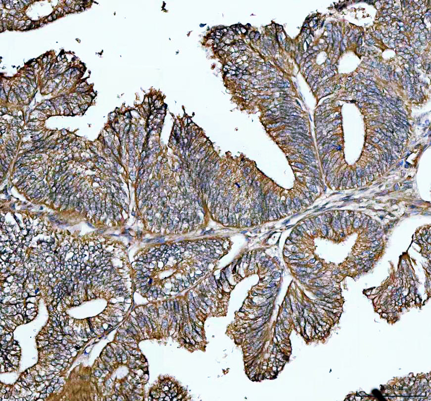 pa1212 ctnnb1 primary antibodies ihc testing 1