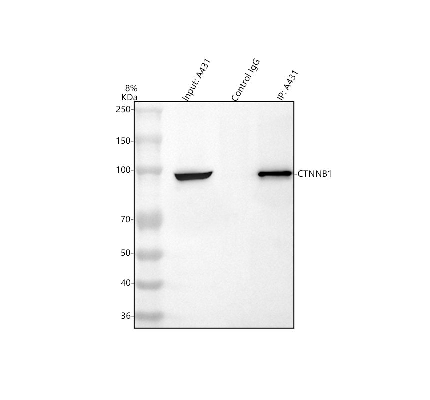 pa1212 ctnnb1 primary antibodies ip testing 1
