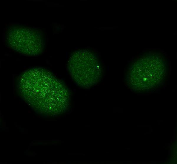 pa1218 xaf1 primary antibodies if testing 2