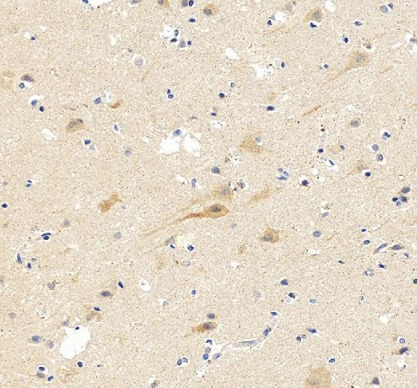 pa1222 grin1 primary antibodies ihc testing 3