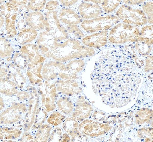 pa1232 bcl2l1 primary antibodies ihc testing 3