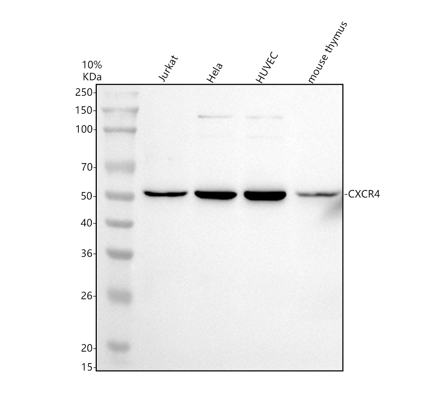 Western blot analysis of CXCR4 using anti-CXCR4 antibody (PA1237)